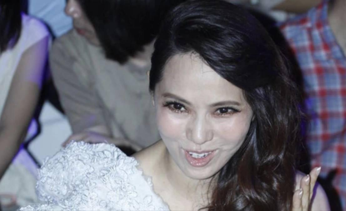 面部衰老皱纹解剖图,面部皱纹衰老对比图