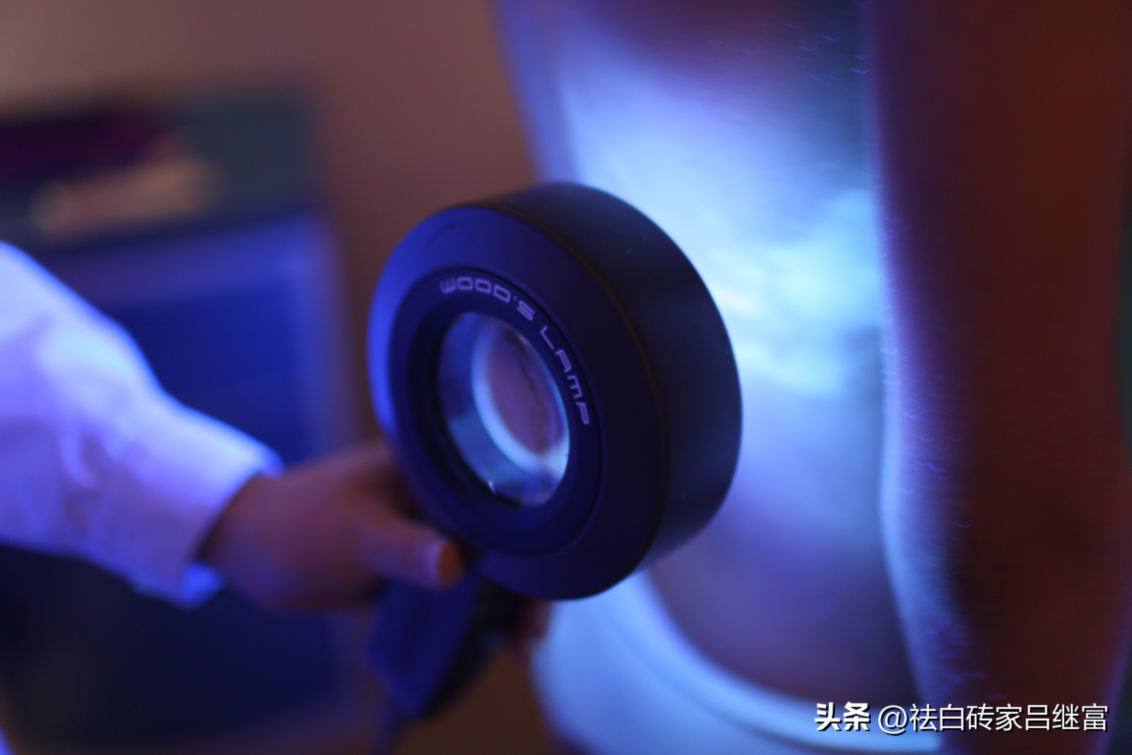 快速区分白癜风和无色素痣,早期白癜风是色素减退吗