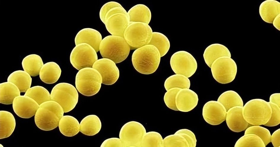 抗氧成分防晒,抗氧的防晒成分有哪些