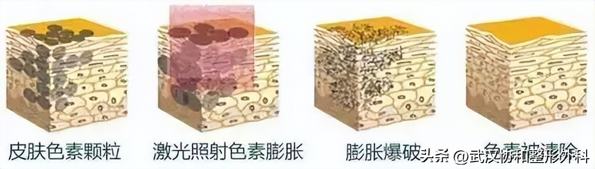 皮肤干燥痒痒起疹子怎么办,皮肤痒血燥是怎么引起的