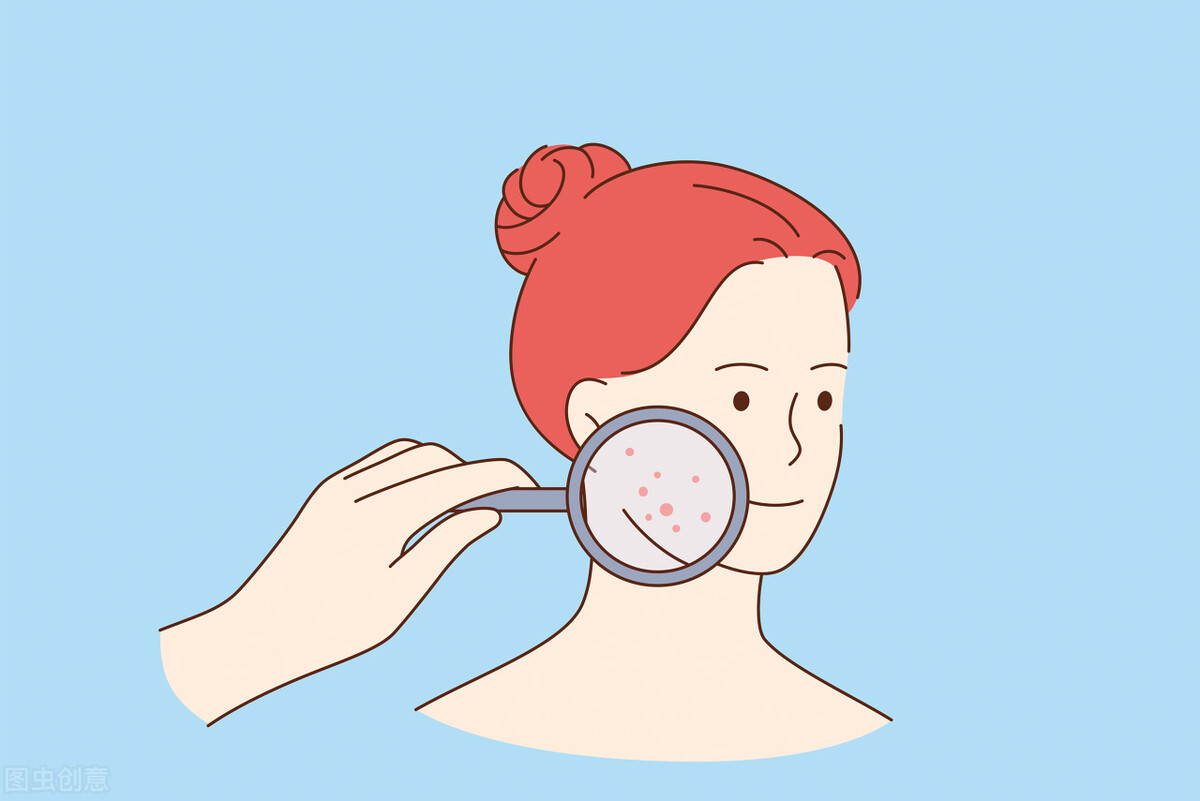 敏感皮肤该如何治疗,你是敏感肌肤吗