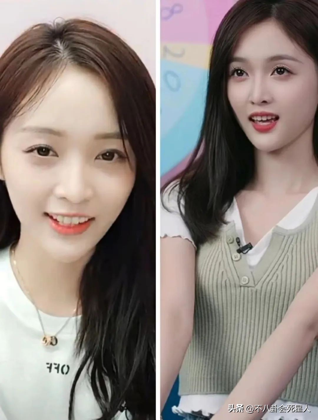 烤瓷牙有多恐怖,烤瓷牙害我一生