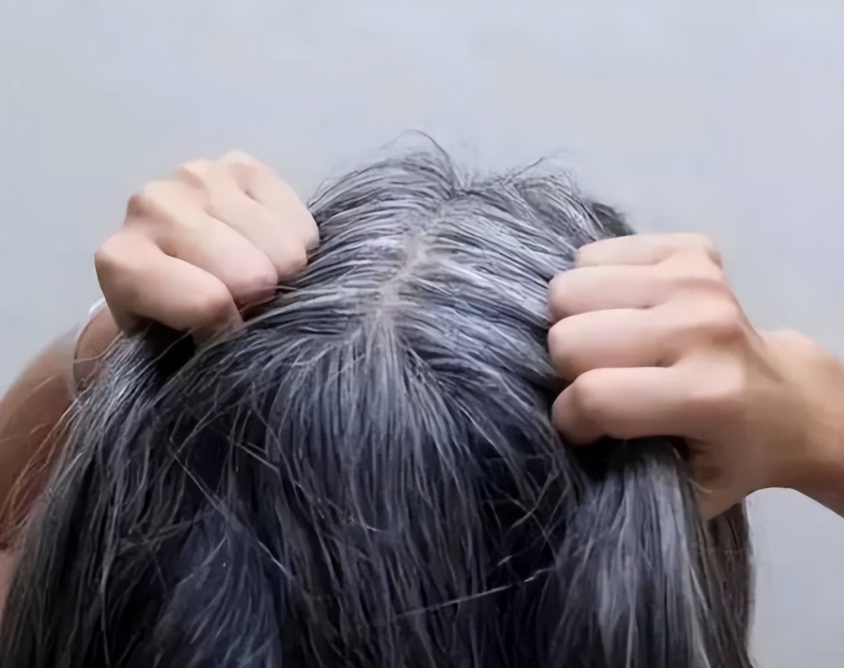 白头发越来越多是什么原因27岁,白头发越来越多是什么原因24岁