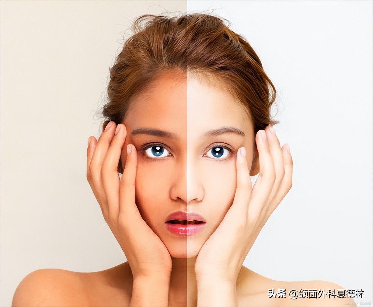 歪下巴正颌手术,颞颌关节紊乱下巴歪复位