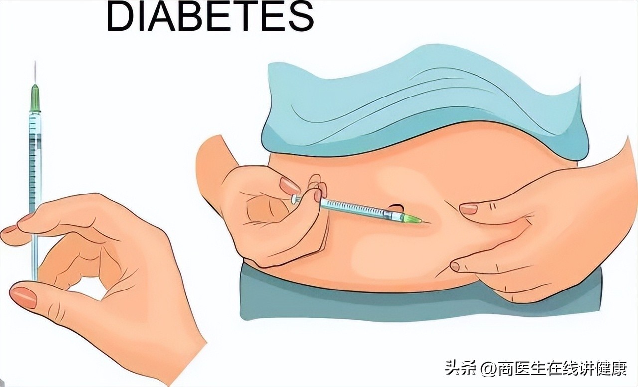 降糖药达格列净长期吃有什么害处,揭密降糖神药达格列净健康科普
