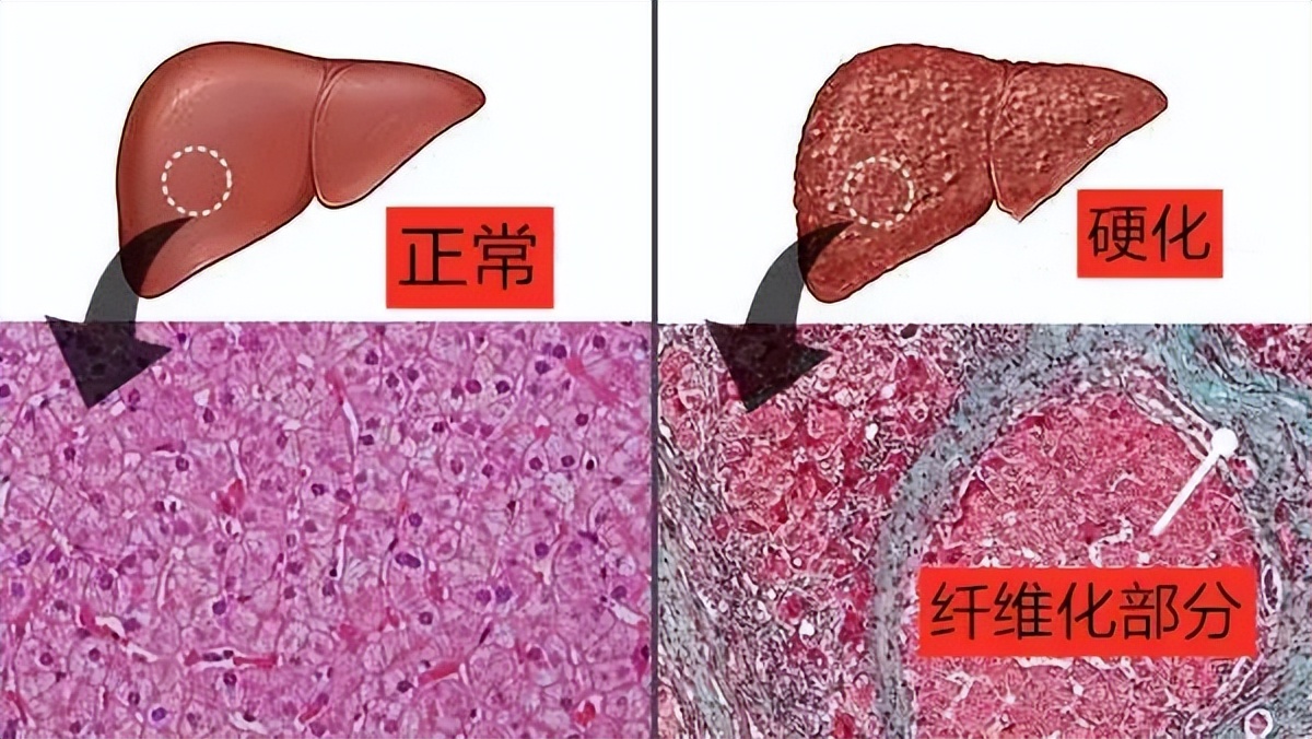 科普｜猫咪的肝病究竟是什么？本文告诉你如何预防