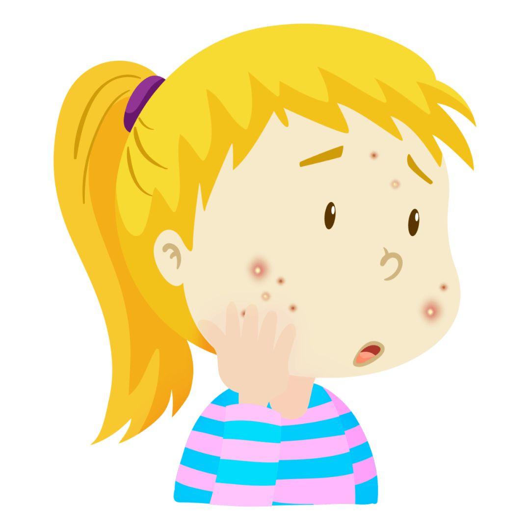 男生吃异维a酸有副作用吗,童诺异维a酸红霉素副作用