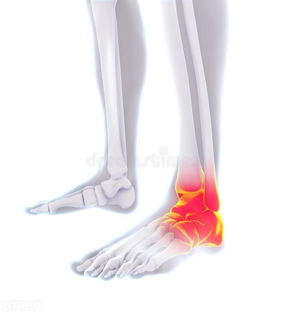 距骨软骨坏死和损伤多久可以走路,距骨软骨损伤能走路吗