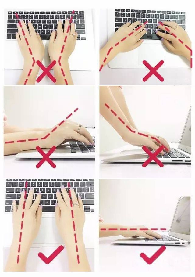 鼠标手腕管综合征挂什么科,白领鼠标手腕管综合征