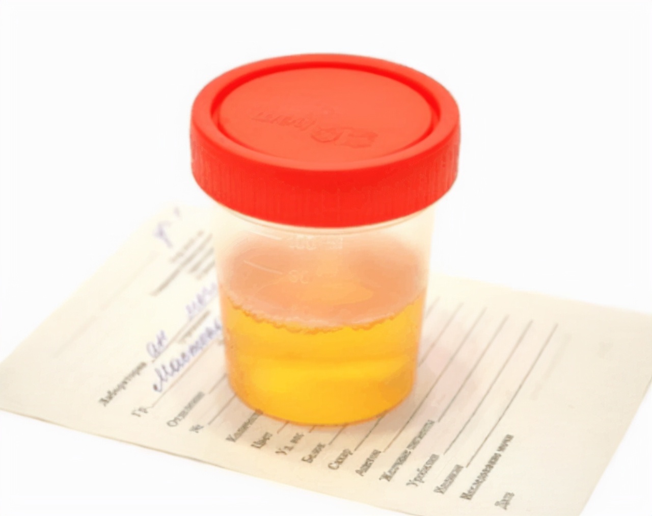 上厕所尿液偏黄是上火了吗,上厕所尿液黄是怎么回事