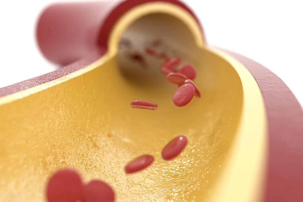 脸上有斑，体内必瘀，一碗消斑汤，还你一张洁净透亮的脸！