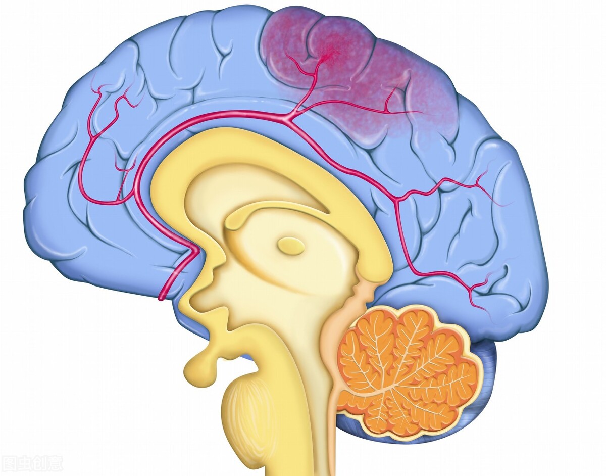 治疗脑梗的名老中医专家,国家级名老中医治疗脑梗