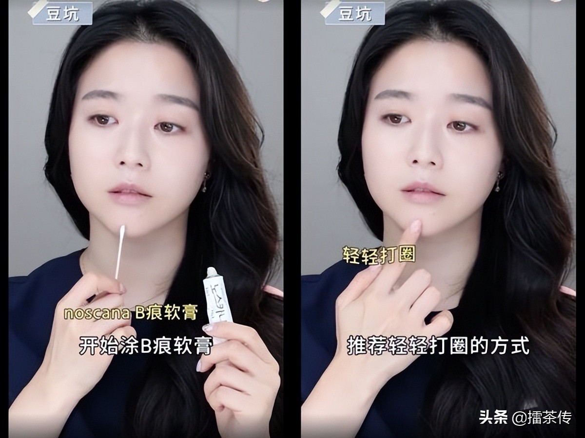 痘疤用什么药膏祛痘好用,痘疤脸怎么护肤