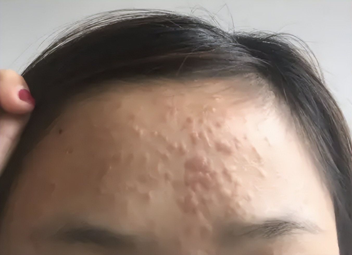 眼睛周围总感觉有飞虫是怎么回事,眼睛周围有飞虫的感觉