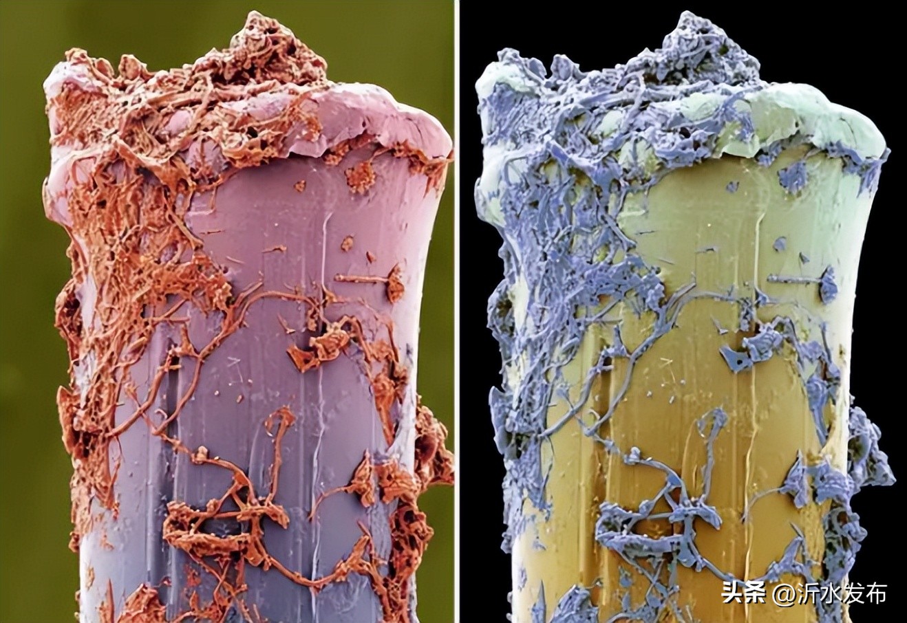 牙齿上都是黑斑用什么牙膏,怎么刷牙都有牙斑