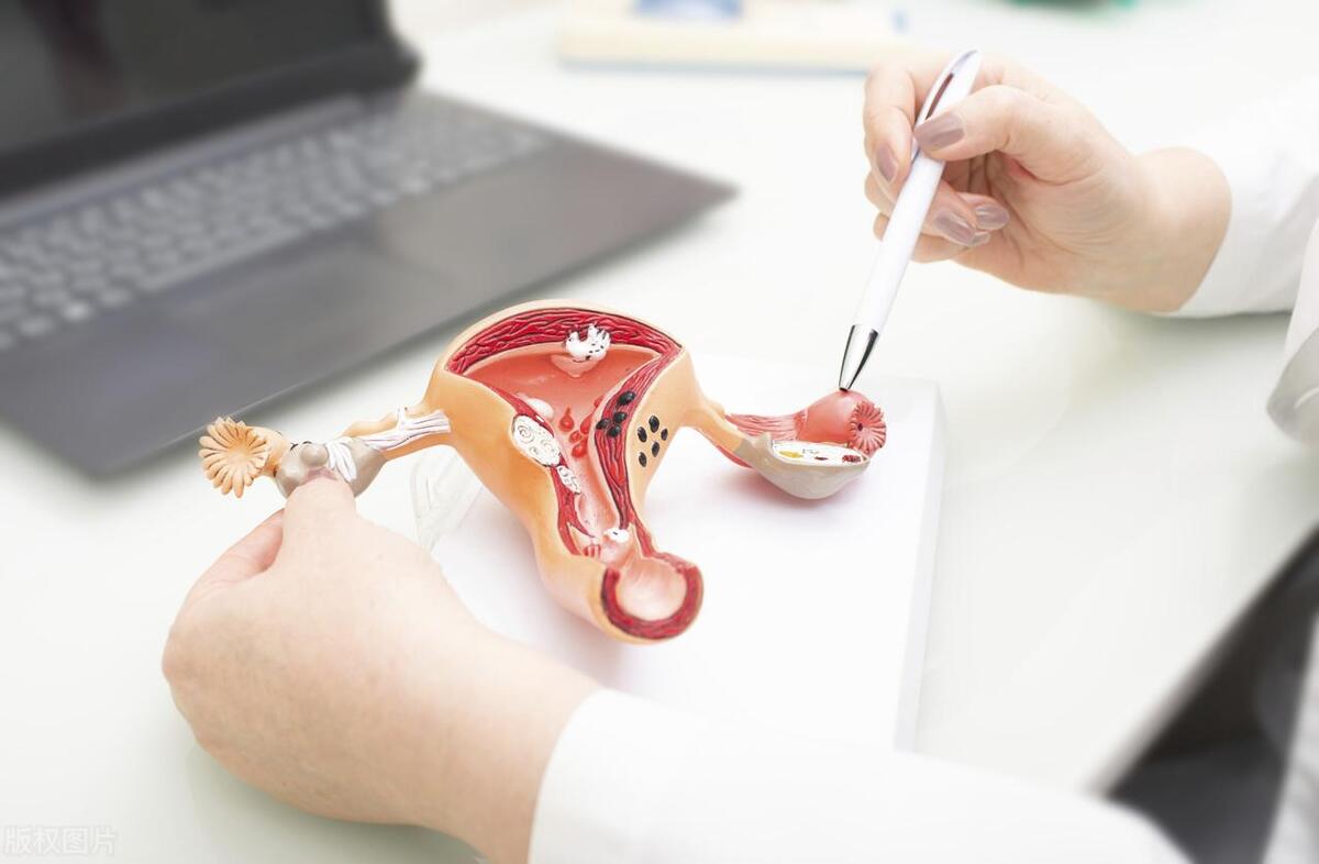 女性巨阴症能结婚么,巨阴症会影响生育吗