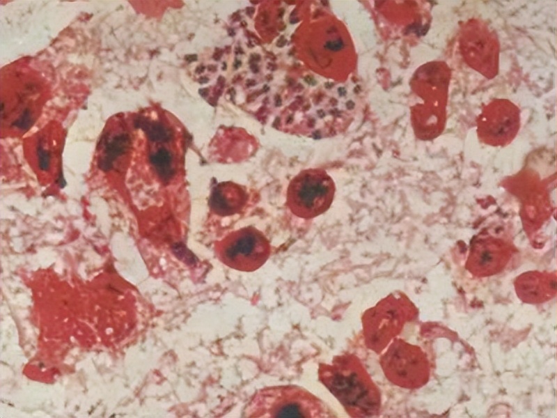 有哪些病可以通过性传播,通过性传播的病不能治愈的有哪些