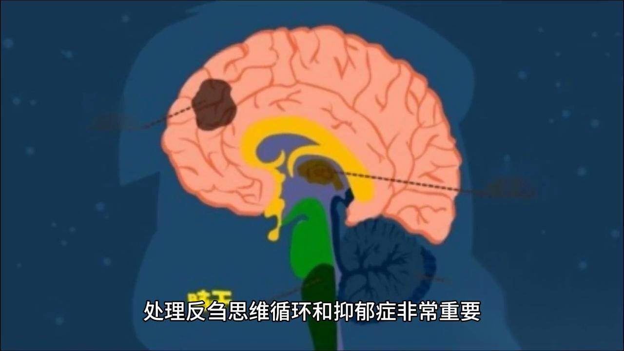 思维反刍怎么心理治疗,如何克服反刍心理