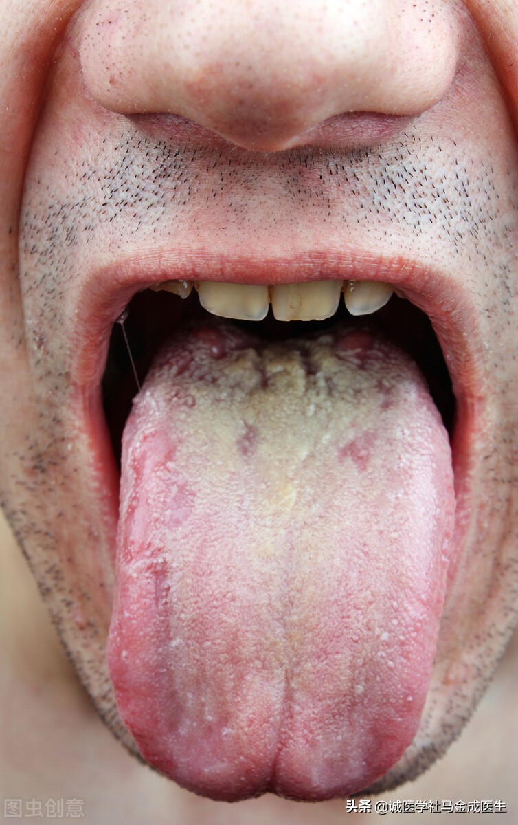 暑湿感冒和风寒风热的区别,暑湿风寒风热都可以用的药有