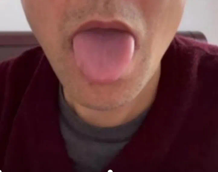 中医怎样治焦虑性失眠,治失眠焦虑有什么中药