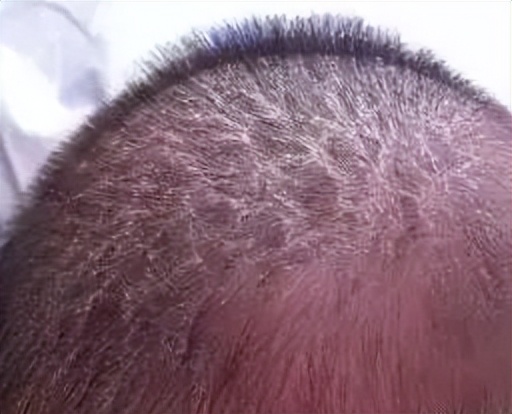 如何护理宝宝的头,如何养护宝宝头发