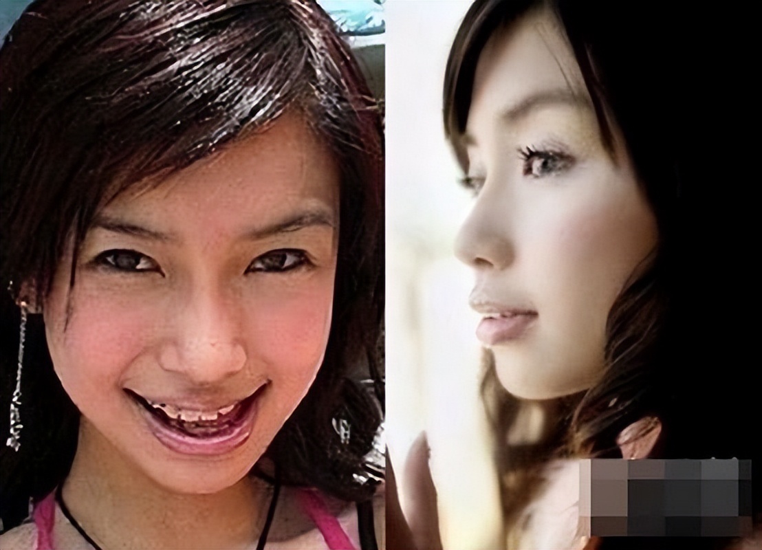 垫屁垫，烤瓷牙，戴美瞳：这些女明星的修修补补，看得人眼花缭乱