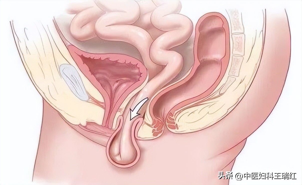 记住这十条让你远离妇科病,想要远离妇科病你得先做好这一步