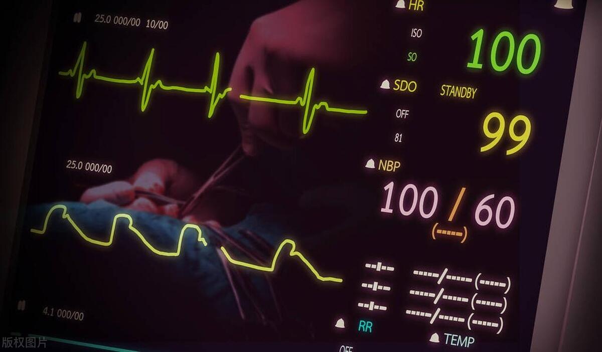 全身麻醉到死亡有知觉吗,全身麻醉就像死过一次