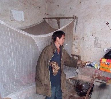 男子手长满树疙瘩是什么病,男子手长满树疙瘩手术了吗