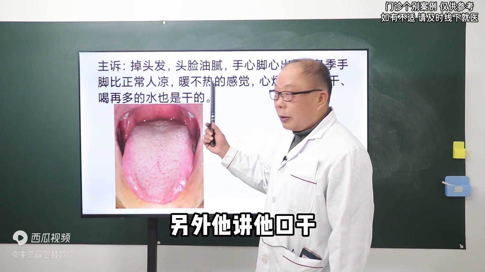 头脸出油手脚凉寒热错杂脾虚这样通阳气就好了