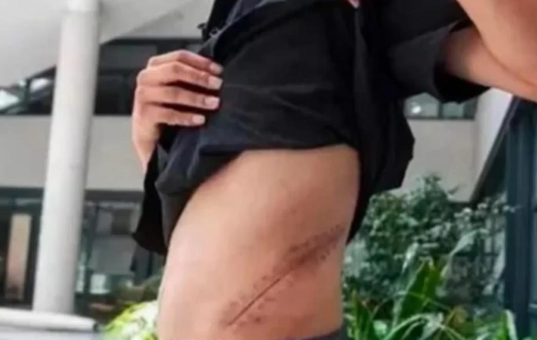 拿肾换苹果的王刚现在过得怎么样,当年卖肾换苹果的少年怎么样了