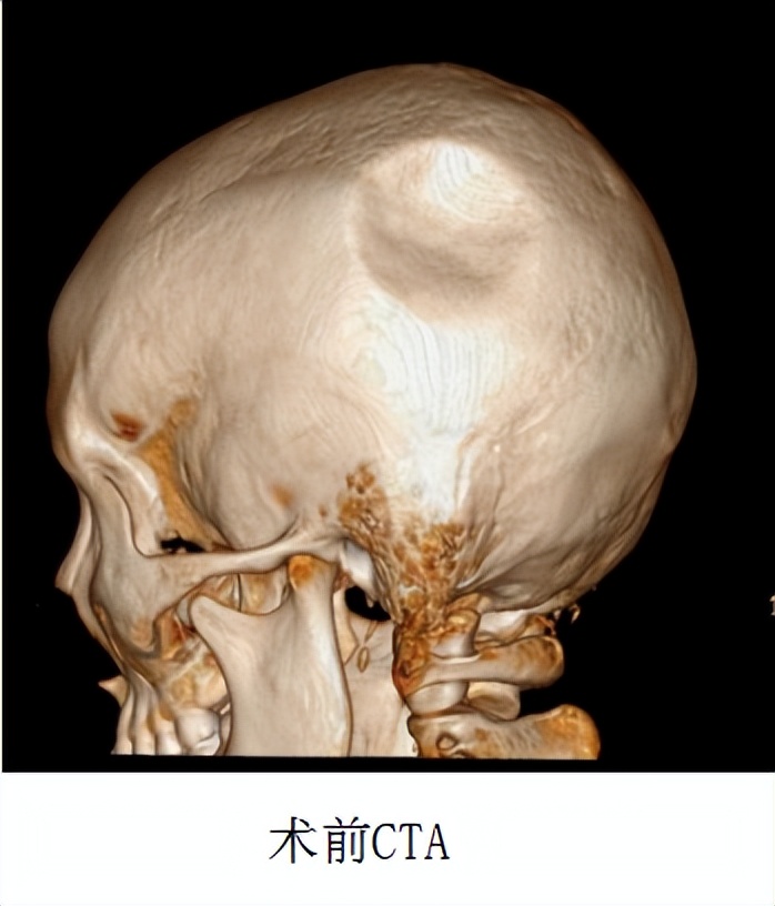 飞来横祸轮胎砸中脑袋,一男孩被铅球砸严重骨折