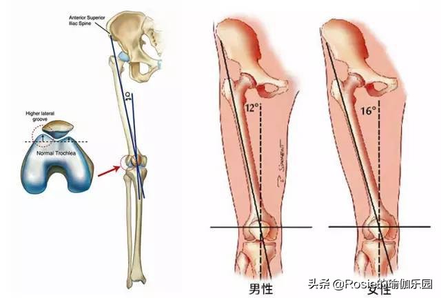 小腿外翻大腿凸起变直的方法,大腿前侧突出小腿外翻怎么瘦最快