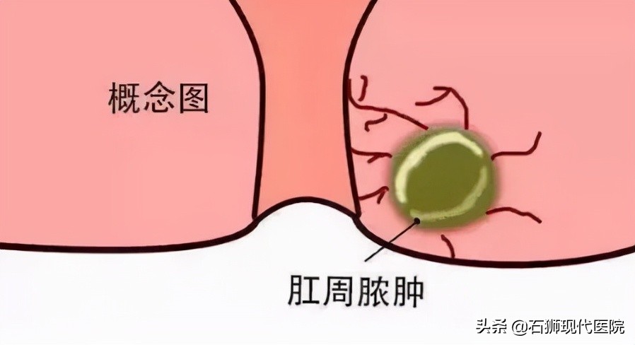 大便时肛门疼痛怎么治疗,大便肛门疼痛用什么药好得快