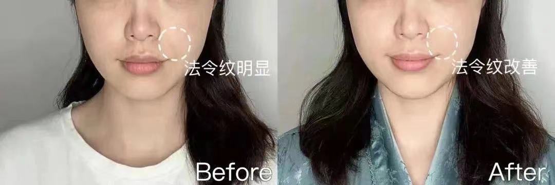 赫莲娜黑绷带面霜真的那么好用吗 (赫莲娜黑绷带面霜什么时间上市)