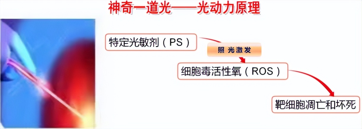 宫颈癌前病变中医能治愈吗,得了宫颈癌前病变的自述