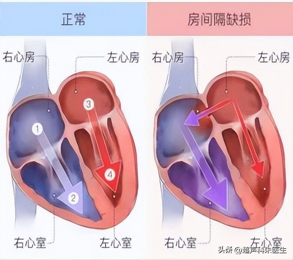 心眼多和心计是好事还是坏事,心眼多心不正