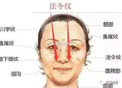 如何消除法令纹小视频,如何消除法令纹泪沟