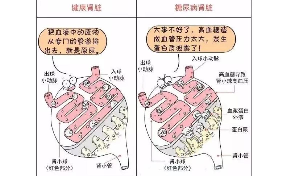 尿毒症晚期吃不下饭是什么原因,尿毒症流鼻血是什么原因引起的