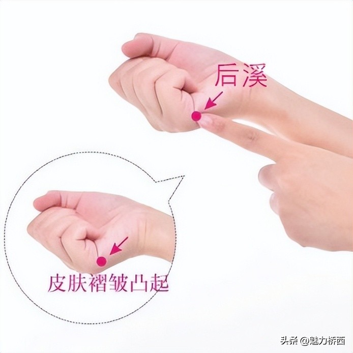 阳康之后头痛怎么办,阳康之后一直头疼是怎么回事