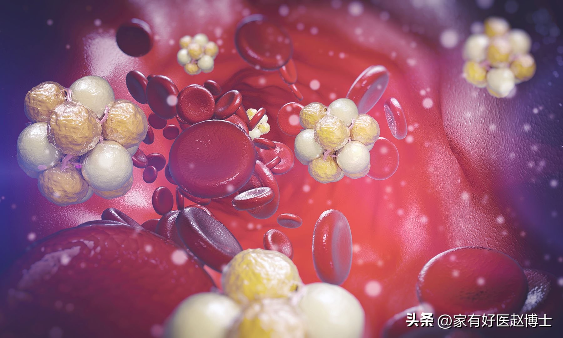 服用他汀类降脂药时牢记三不要,血脂1.1不吃他汀吃血脂康可以吗