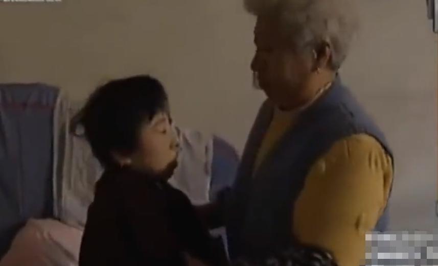 故事：大连39岁姑娘患怪病，皮肤坚硬宛如石膏，专家结论希望渺茫