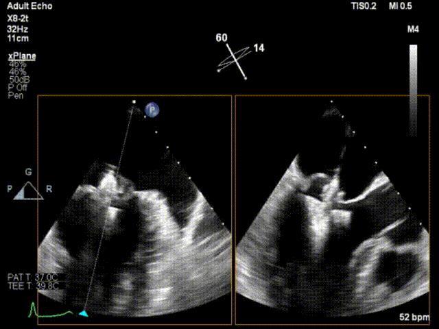 杨剑教授中国科学院,西京医院心血管外科杨剑