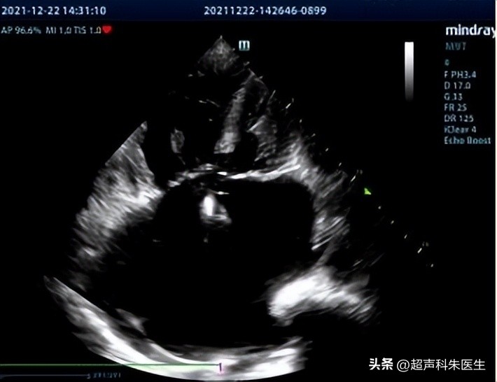 心眼多和心计是好事还是坏事,心眼多心不正