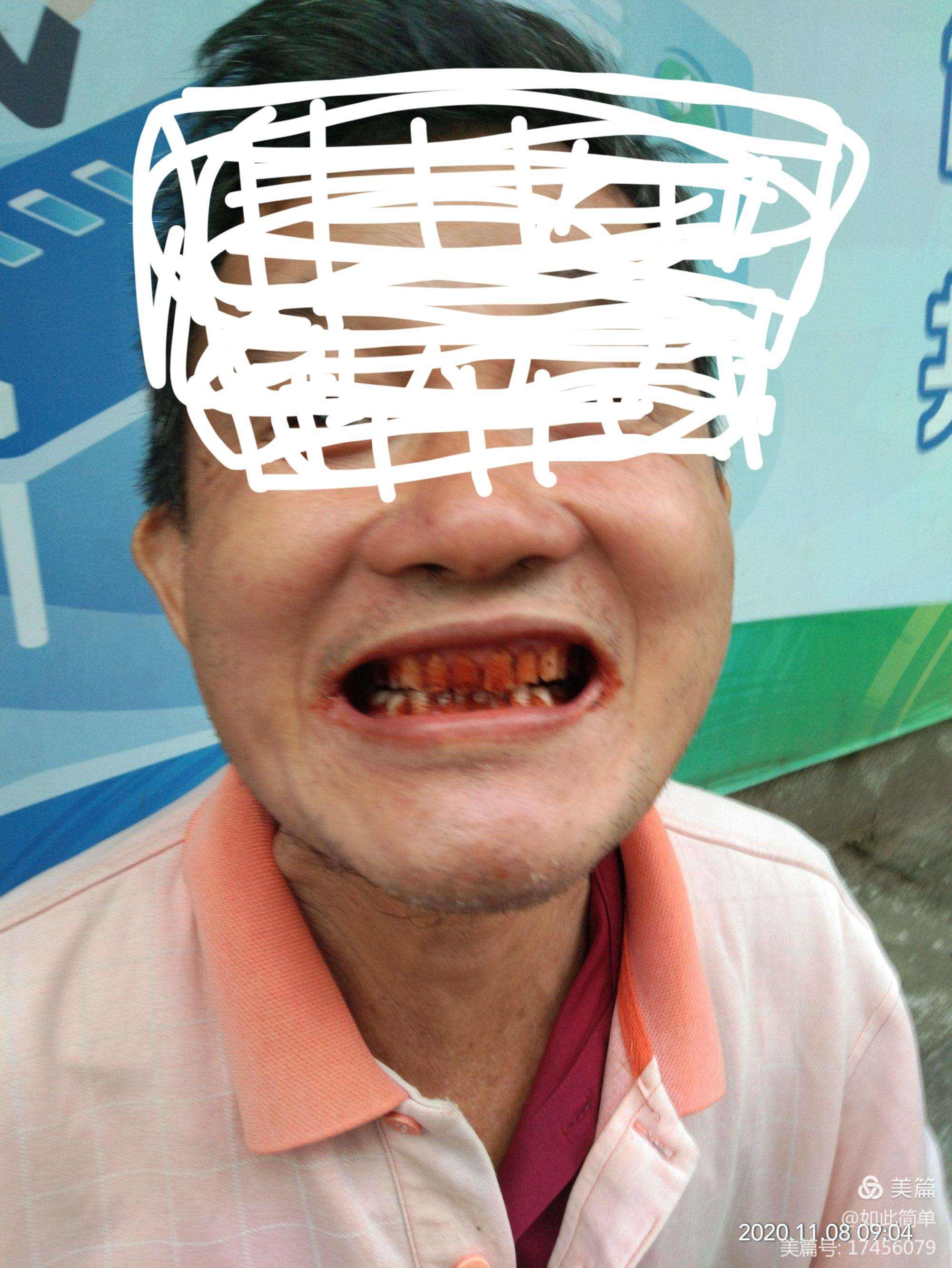 禁售槟榔的危害,禁售槟榔对和成天下的影响