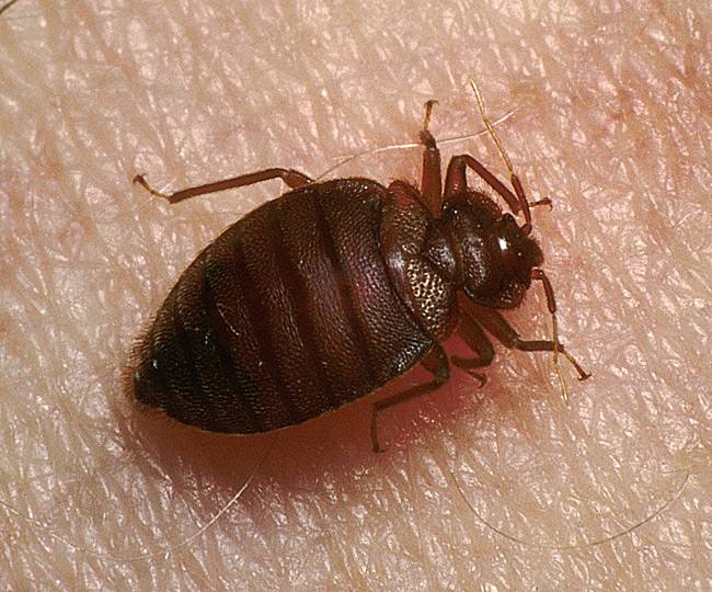 防止床虱叮咬的药,床虱咬后后期怎么处理