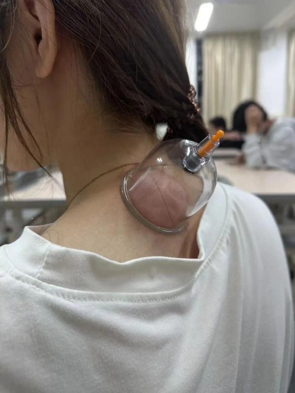 如何养发让头发变多,头发多吃什么能变多