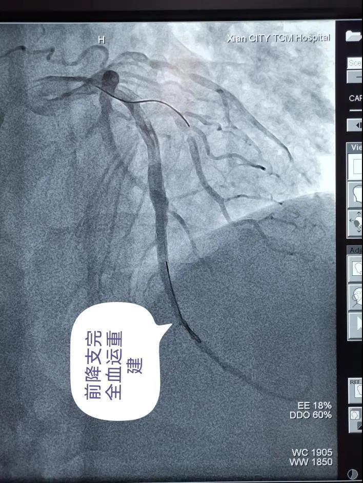 西安市中医医院icu,西安市中医医院oa系统