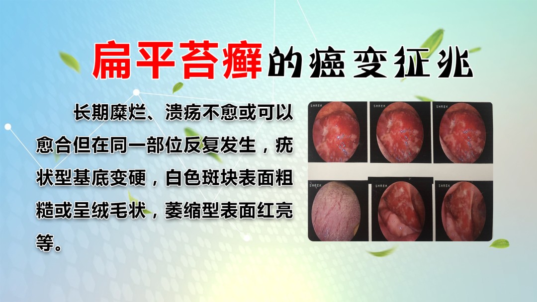 口腔溃疡反复发作，是缺维生素了？你可能一直都错了！改善口腔疾病，这个方法效果好