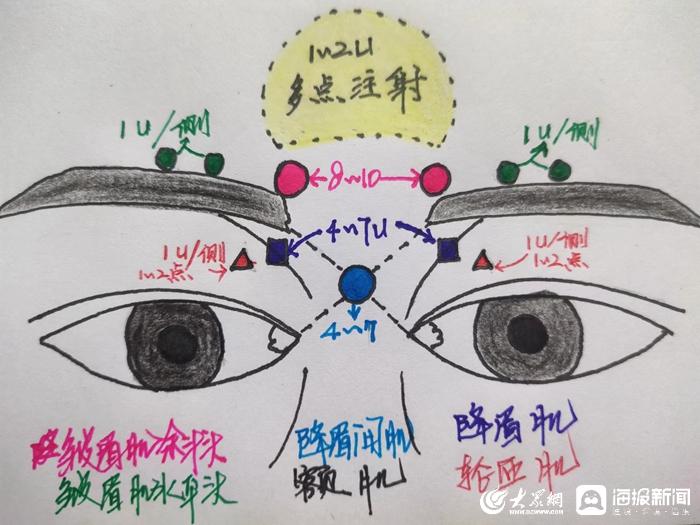 医美整形人群禁忌,爱美须谨慎整形要慎重